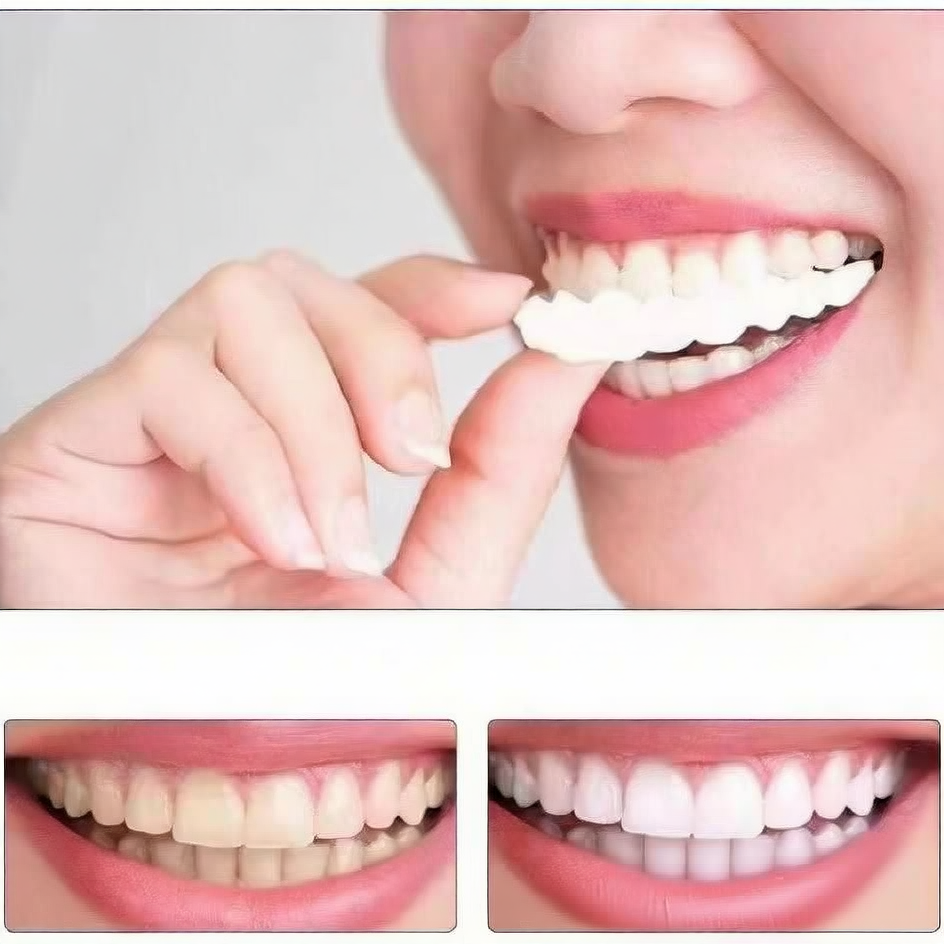 Upper and lower teeth simulation braces