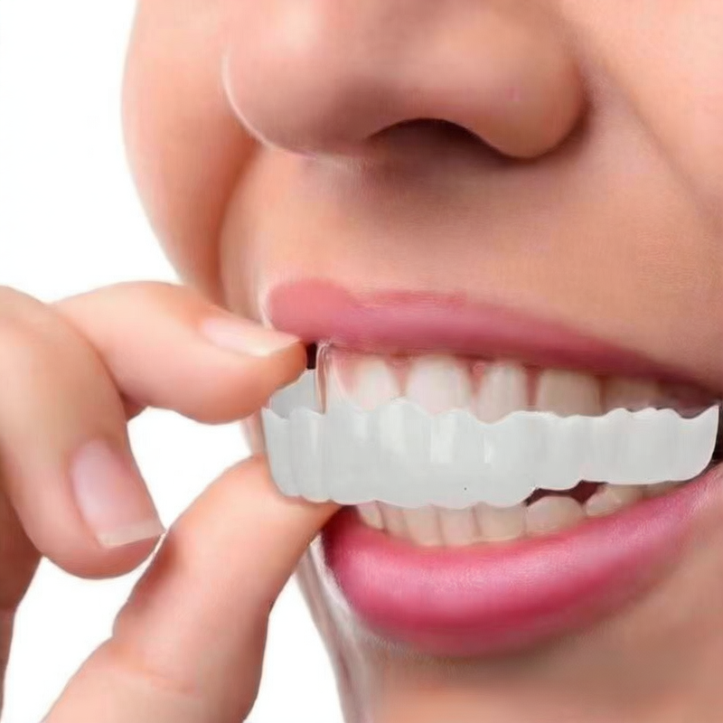 Upper and lower teeth simulation braces
